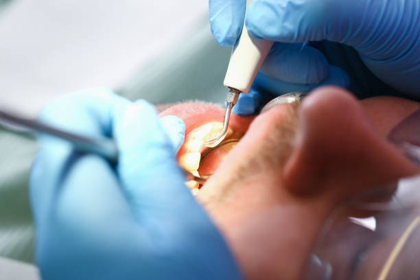 Best Emergency Gum Treatment in Nneconne, WI